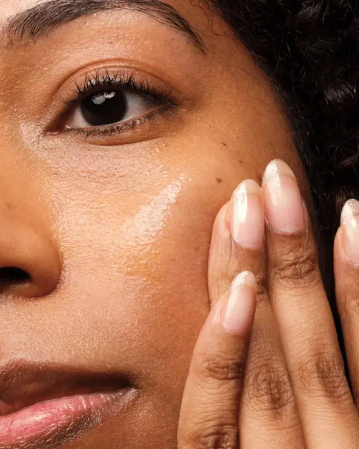 The Ordinary Niacinamide Serum 10% + Zinc 1%- 30 ml